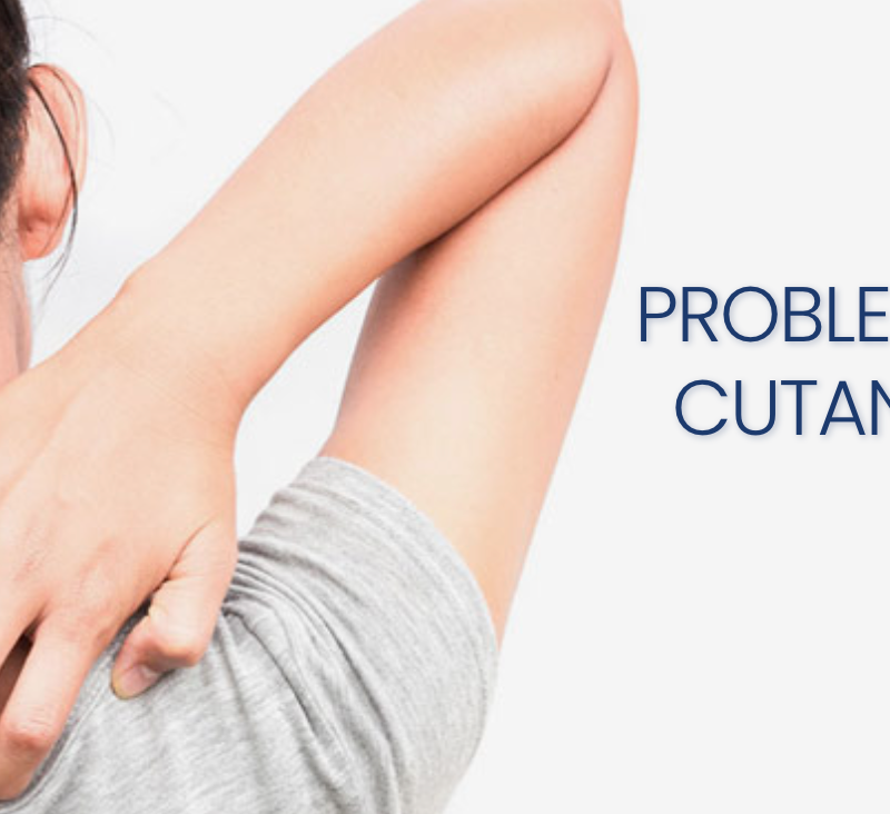 Problemi Cutanei